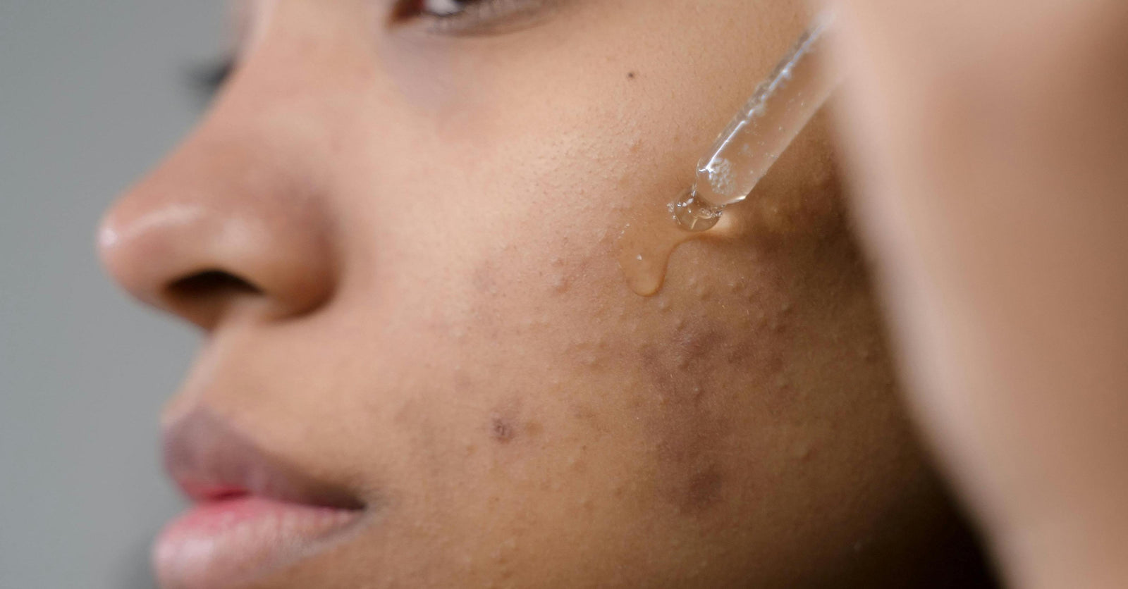 Demystifying  Face Oils