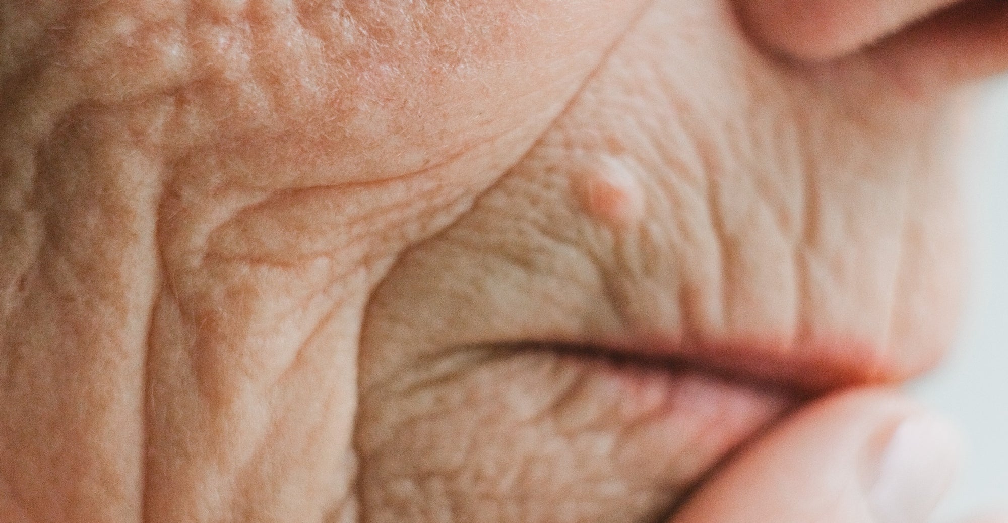 What Causes Skin Aging?