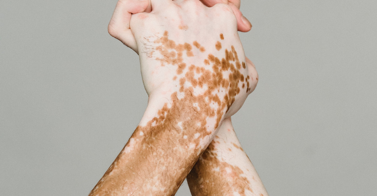 Nutrients for Skin Health