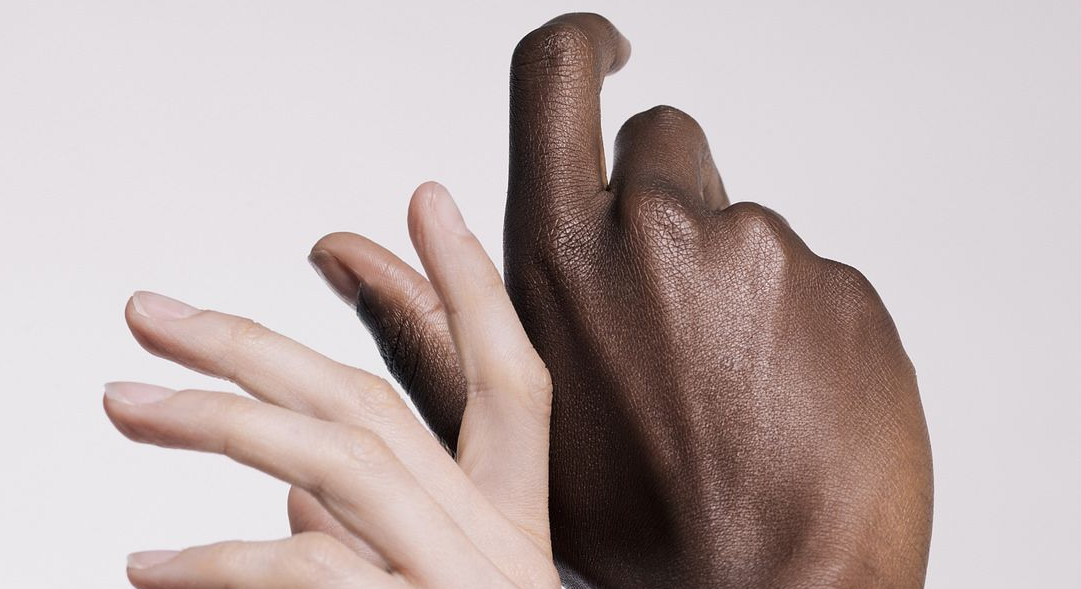 How Genetics Affect Your Skin & Skincare