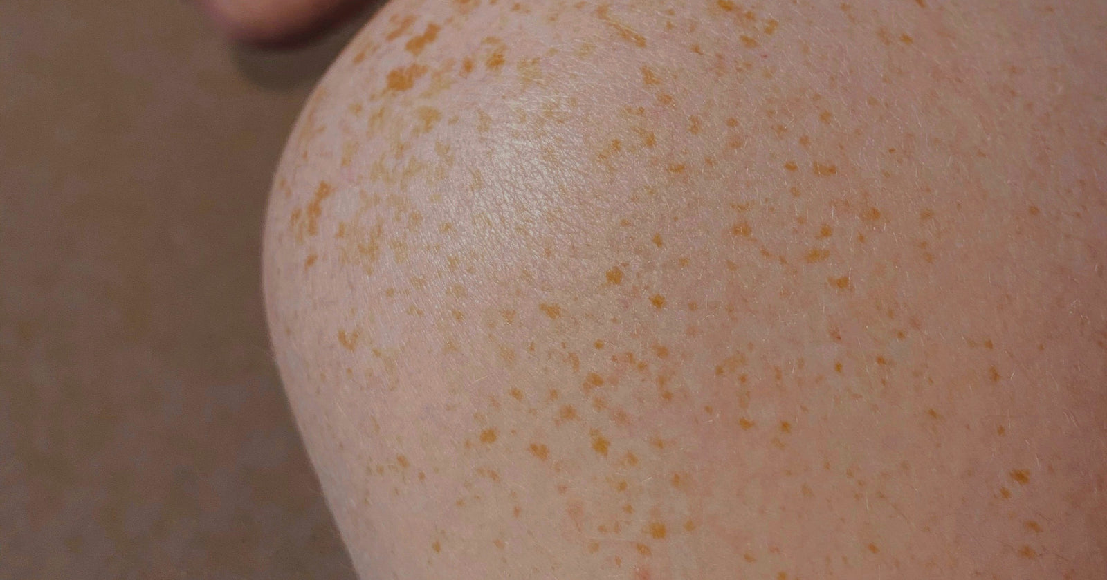 The Structure & Function of Skin